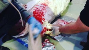 GWO  First Aid Refresher